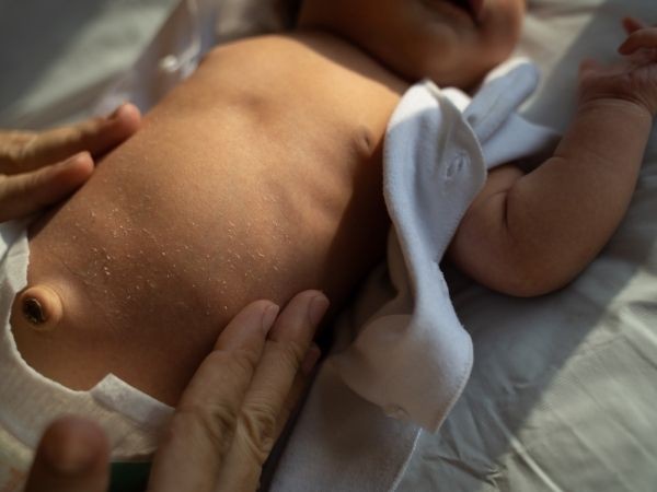 Yenidoğan Bebek Göbek Bağı Bakımı Nasıl Yapılır?