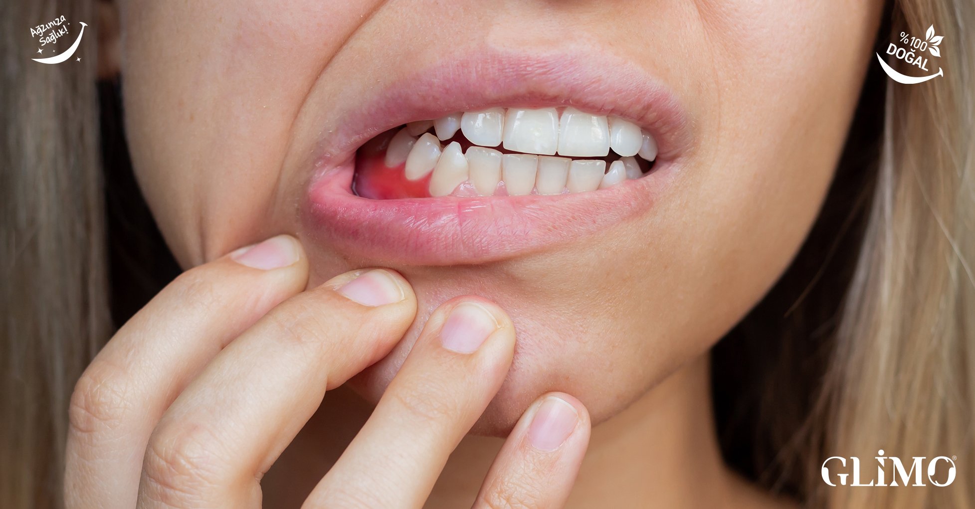 Diş Eti Kanaması: Sinyalleri Okuyun ve Glimo Beta ile Önlem Alın