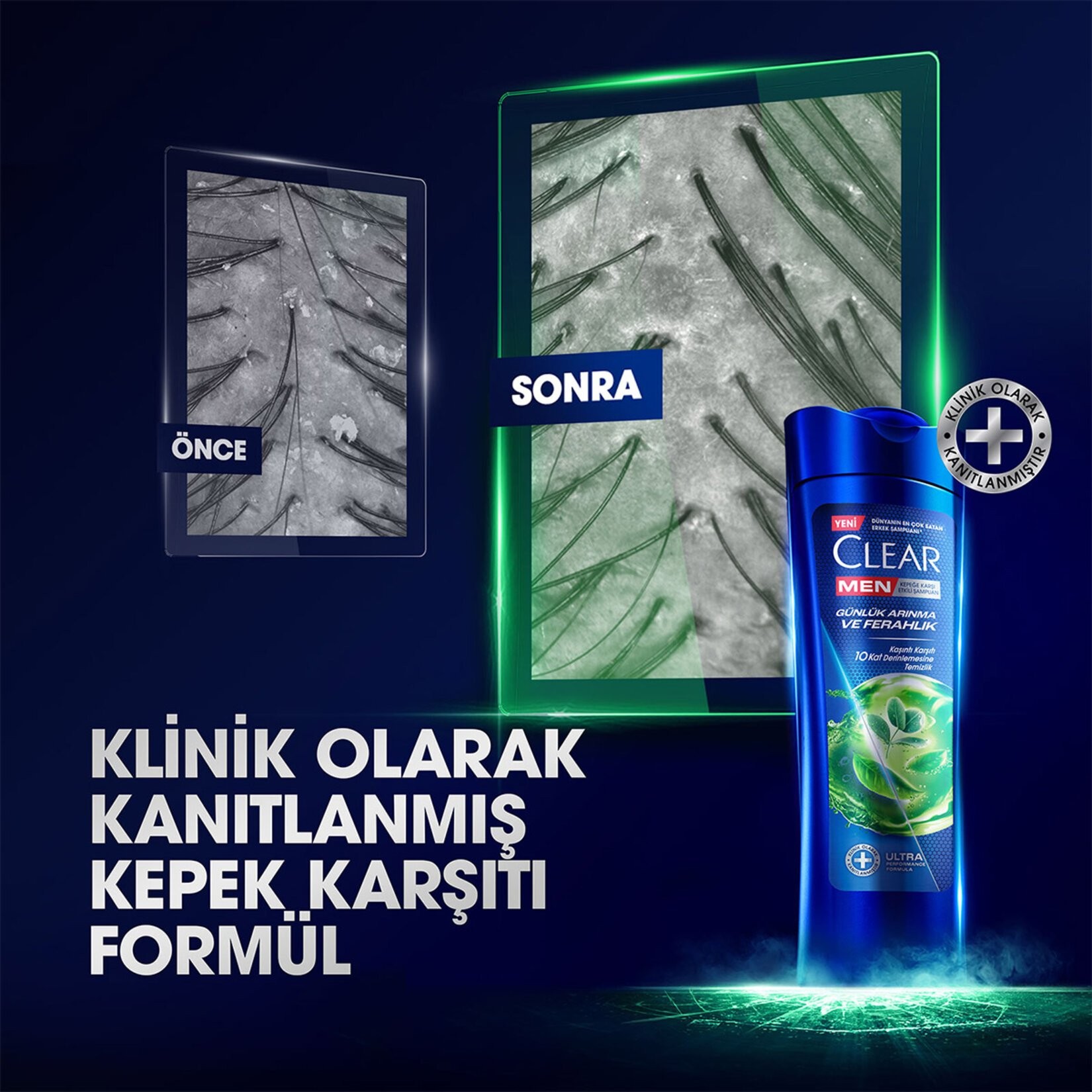 Clear Men Günlük Arınma Ve Ferahlık Etkili Şampuan 350 Ml