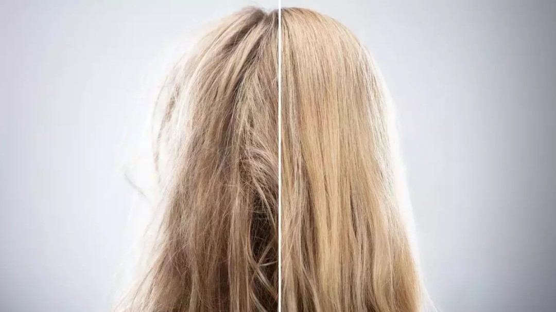 keratin, keratin bakım, yanmış saç, yanan saç, yanan saç nedir, yanan saça bakım, yanmış saça bakım, yıpranan saç, yıpranmış saça bakım, evde yanan saça bakım, yıpranmış saça bakım, yanan saç bakımı, yanan saç düzelir mi, oryalden yanmış saç, fönden yanmış saç, ısıdan yanmış saç, düzleştiriciden yanmış saç, ombreden yanmış saç, yanan saç görüntüsü, yıpranmış saça ne yapılır, yanan saça mucize, en iyi yanan saça bakım, yanan saça tedavi, yanan saça ne yapılmalı,