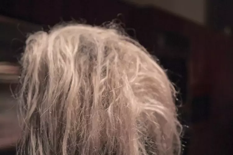 keratin, keratin bakım, keratin nedir, keratin ne işe yarar, keratin nasıl yapılır, yıpranmış saç, yıpranan saça ne yapılır, yanan saç, yıpranan saça evde bakım, yıpranan saça doğal bakım, evde yıpranan saça ne yapılır, yıpranan saça ne kullanılmalı, keratin bakım uygulaması, çok yıpranmış saç, keratin seti, onarıcı keratin, kırılan saç, kopan saç, dökülen saç, 