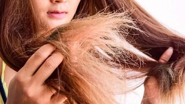 Açıcıdan Boyadan Yanmış Saç Görüntüsü Nasıldır? Lastik gibi uzayan kopan saçlar, tiftik saçlar, süpürge teli olan saçlar, keçe gibi olan saçlar,