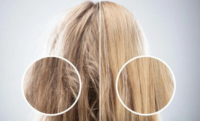 keratin, keratin bakım, yanmış saç, yanan saç, yanan saç nedir, yanan saça bakım, yanmış saça bakım, yıpranan saç, yıpranmış saça bakım, evde yanan saça bakım, yıpranmış saça bakım, yanan saç bakımı, yanan saç düzelir mi, oryalden yanmış saç, fönden yanmış saç, ısıdan yanmış saç, düzleştiriciden yanmış saç, ombreden yanmış saç, yanan saç görüntüsü, yıpranmış saça ne yapılır, yanan saça mucize, en iyi yanan saça bakım, yanan saça tedavi, yanan saça ne yapılmalı,