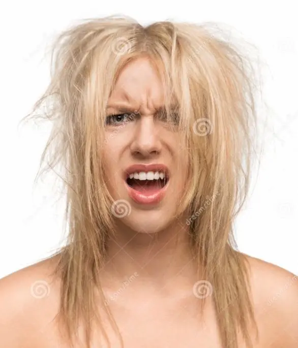 Kopan saç, Yanan saç görüntüsü, yanan saç nasıl olur, esneyen saç, uzayan saç, hamur saç, tiftik saç, sünger saç, lastik gibi uzayan saç, saç esnemesi, yanmış saç görüntüsü, kırık saç