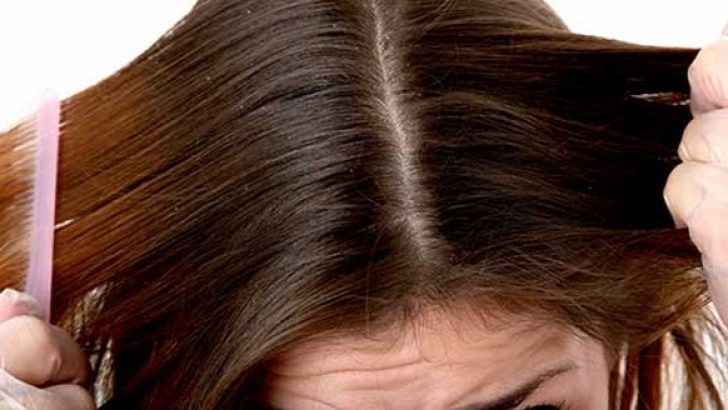 keratin, keratin nedir, keratin bakım, yanmış saç, yanan saç, yanan saç görüntüsü, yanmış saç görüntüsü, yanan saç nedir, yanan saça bakım, yanmış saça bakım, yıpranan saç, yıpranmış saça bakım, evde yanan saça bakım, yanan saç bakımı, yanan saç düzelir mi, açıcıdan yanmış saç, oryalden yanmış saç, fönden yanmış saç, ısıdan yanmış saç, düzleştiriciden yanmış saç, ombreden yanmış saç, yıpranmış saça ne yapılır, yanan saça mucize, en iyi yanan saça bakım, yanan saça tedavi, yanan saça ne yapılmalı, yanan saça çözüm, yanan saça bakım,
