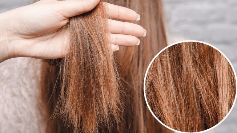 keratin, keratin nedir, keratin bakım, kırık saç, kırılmış saç, kırık saça çözüm, kırık saça ne yapılır, kırık saça tedavi, kırık saça bakım, kırık saça keratin, kırık saça keratin bakımı, yanmış saç, yanan saç, yanan saç nedir, yanan saça bakım, yanmış saça bakım, yıpranan saç, yıpranmış saça bakım, evde yanan saça bakım, yanan saç bakımı, yanan saç düzelir mi, açıcıdan yanmış saç, oryalden yanmış saç, fönden yanmış saç, ısıdan yanmış saç, düzleştiriciden yanmış saç, ombreden yanmış saç, yanan saç görüntüsü, yıpranmış saça ne yapılır, yanan saça mucize, en iyi yanan saça bakım, yanan saça tedavi, yanan saça ne yapılmalı, yanan saça çözüm,