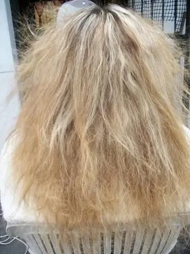 Yanmış Saç Nasıl Onarılır, keratin, keratin nedir, keratin bakım, yanmış saç, yanan saç, yanan saç nedir, yanan saça bakım, yanmış saça bakım, yıpranan saç, yanmış saç nasıl onarılır, yıpranmış saç nasıl onarılır yanan saç onarımı, yıpranmış saça bakım, evde yanan saça bakım, yanan saç bakımı, yanan saç düzelir mi, açıcıdan yanmış saç, oryalden yanmış saç, fönden yanmış saç, ısıdan yanmış saç, düzleştiriciden yanmış saç, ombreden yanmış saç, yanan saç görüntüsü, yıpranmış saça ne yapılır, yanan saça mucize, en iyi yanan saça bakım, yanan saça tedavi, yanan saça ne yapılmalı, yanan saça çözüm,  kopan saça ne iyi gelir, lastik gibi uzayan saç, saç esnemesi, esneyen saç, tiftikleşen saç, hamur saç, süpürge teli gibi saç, sünger saç,&nbsp;