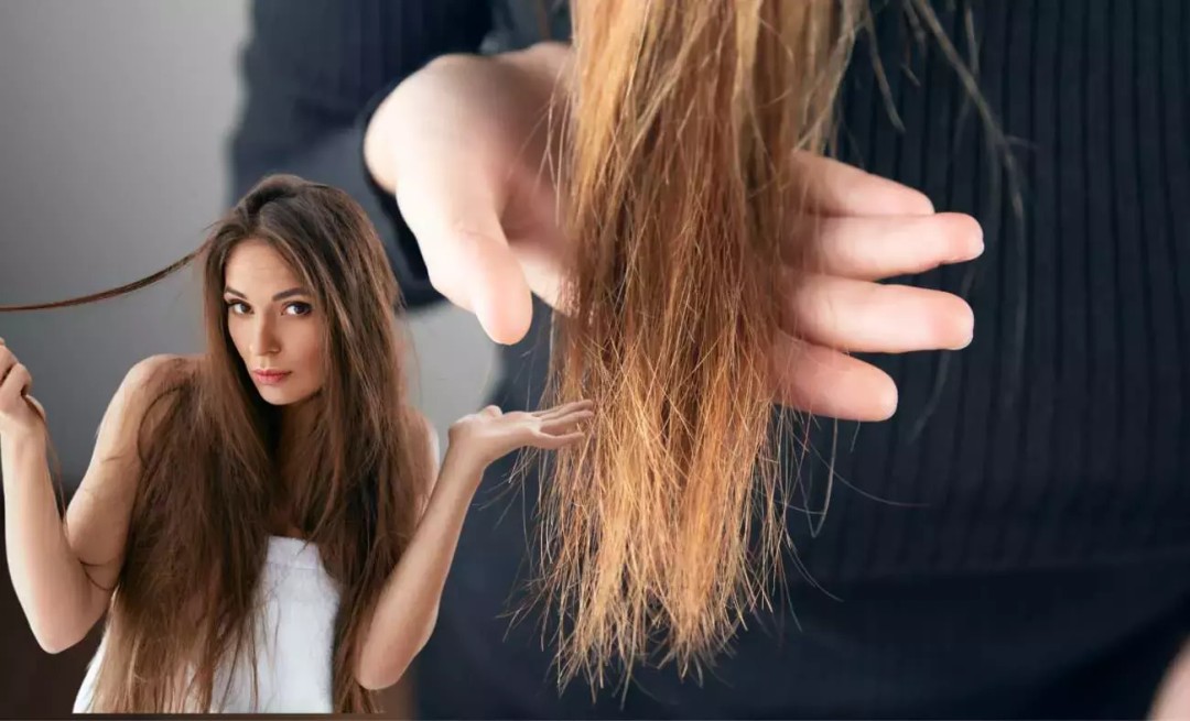 keratin, keratin bakım, yanan saç düzelir mi, yanmış saç, fönden yanan saç, fönden yanmış saç, fönden yanan saça ne yapılır, yıpranmış saç, yanan saç, kopan saç, kırık saç, yanmış saç görüntüsü, yanan saça ne iyi gelir, yanan saça ne yapılır, saçım yandı ne yapmalıyım, evde yanan saça ne yapılır, yanan saça bakım, evde keratin bakımı, yanan saça mucize, yanan saça çözüm, yanan saça çare, boyadan yanan saç, oryalden yanan saç, açıcıdan yanan saç, yanmış saç nasıl olur, yanmış saç nasıl anlaşılır, yanan saçın belirtileri nelerdir,