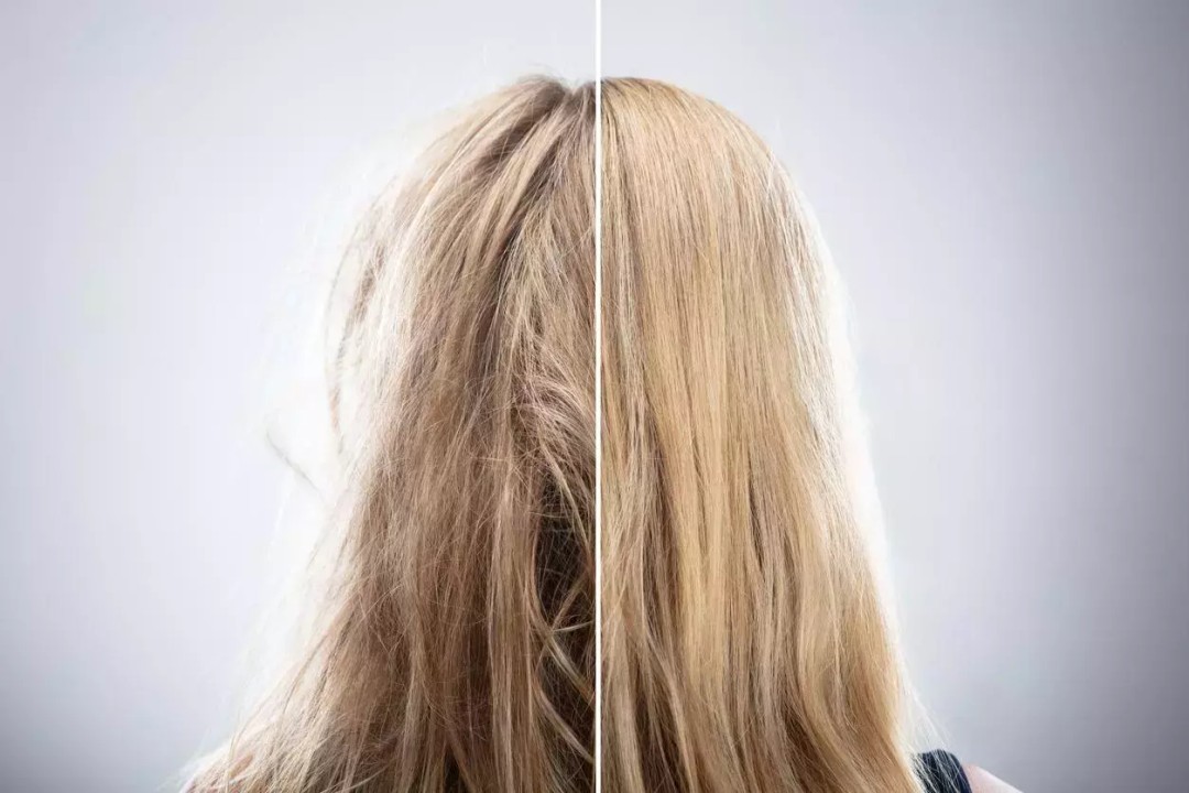 keratin, keratin nedir, keratin bakım, yanmış saç, yanan saç, yanan saç nedir, yanan saça bakım, yanmış saça bakım, yıpranan saç, yıpranmış saça bakım, evde yanan saça bakım, yanan saç bakımı, yanan saç düzelir mi, açıcıdan yanmış saç, oryalden yanmış saç, fönden yanmış saç, ısıdan yanmış saç, düzleştiriciden yanmış saç, ombreden yanmış saç, yanan saç görüntüsü, yıpranmış saça ne yapılır, yanan saça mucize, en iyi yanan saça bakım, yanan saça tedavi, yanan saça ne yapılmalı,  yanan saça çözüm,