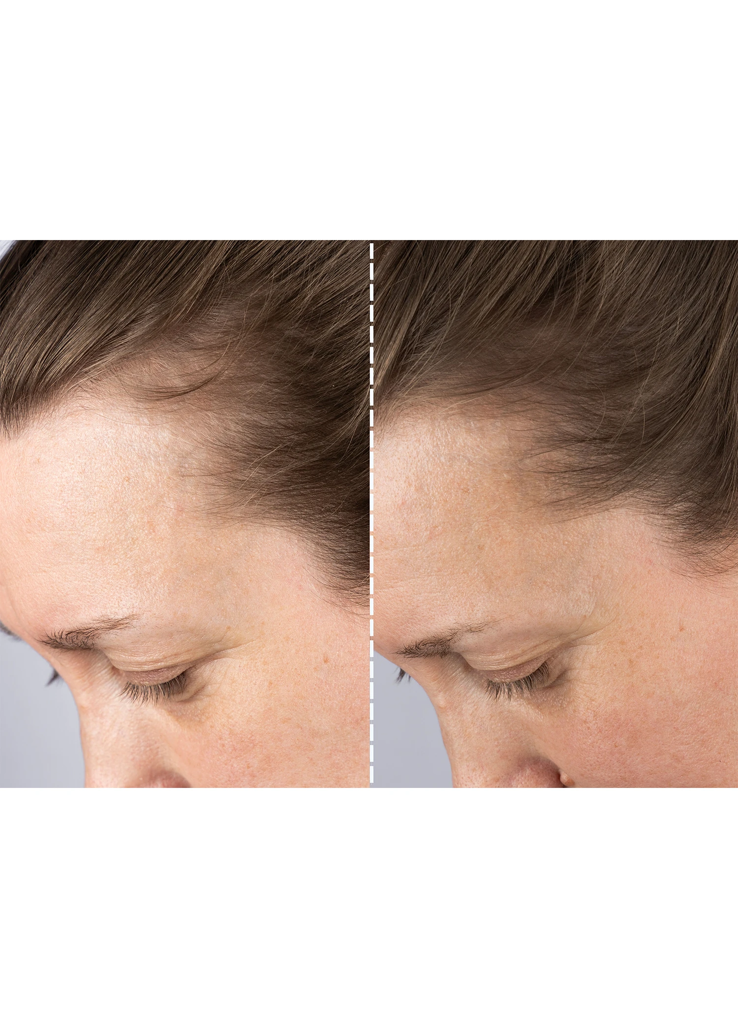 LED Orta Boy Saç Geliştirici Bakım Cihazı