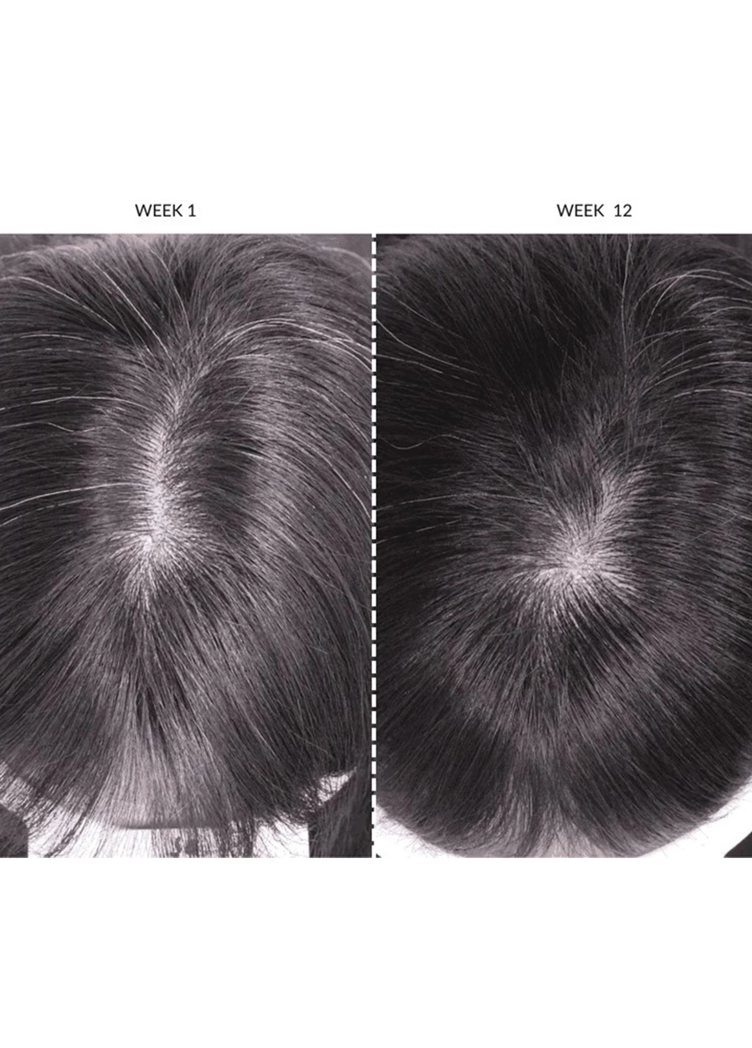 LED Orta Boy Saç Geliştirici Bakım Cihazı