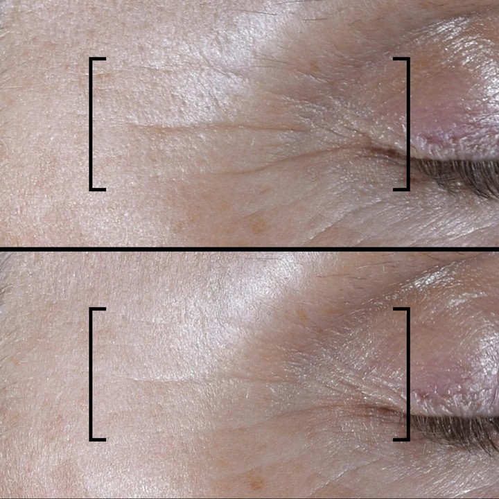 Time Filler Shot 5XP Kırışıklık Karşıtı Konsantre Serum 15 ml