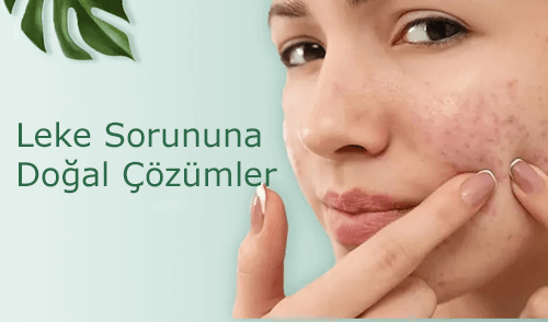 Cilt Lekeleri İçin Etkili Doğal Serum Önerileri