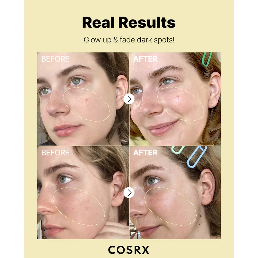 Cosrx Vitamin C 23 Serum 20gr - Leke Karşıtı Vitamin C Serumu