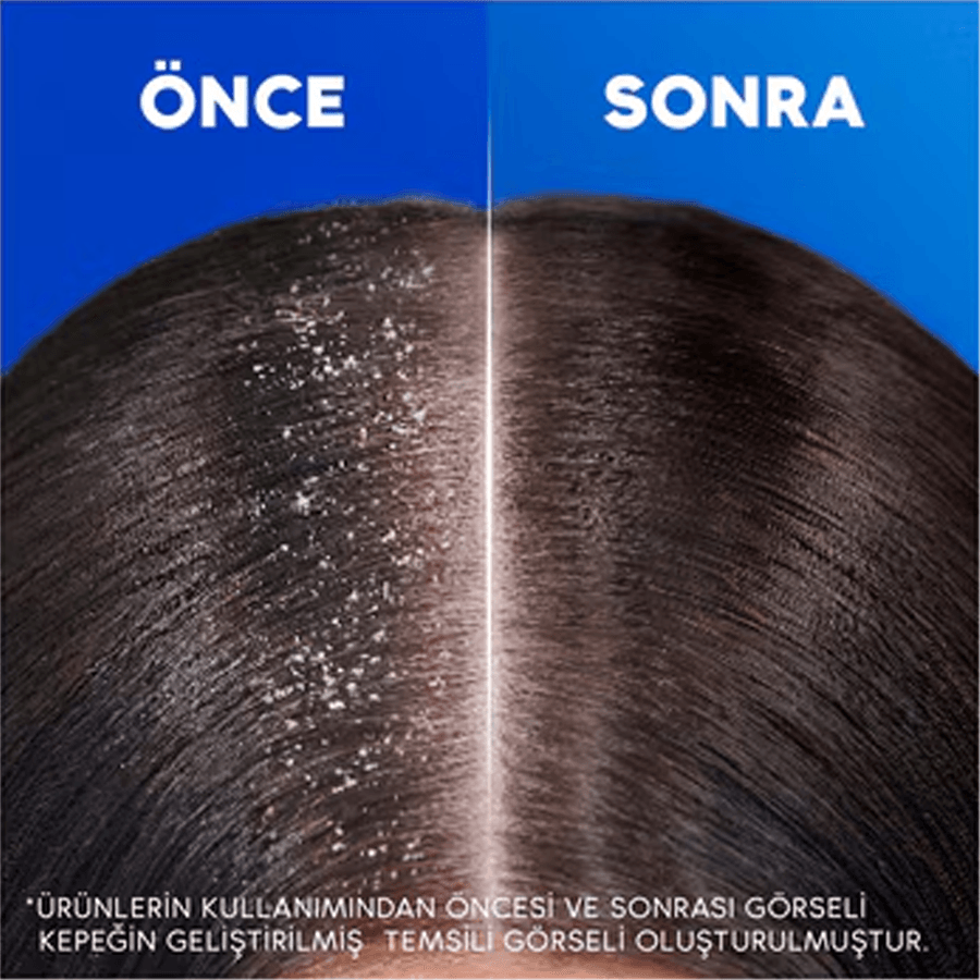 Head & Shoulders Şampuan Derinlemesine Nemlendirici 330ml-Kepeğe Karşı