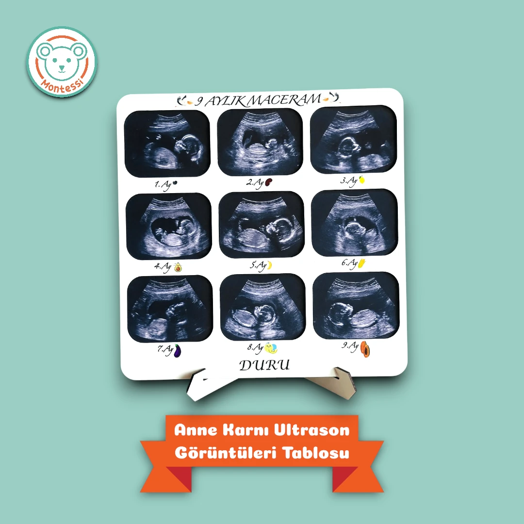 Anne Adayları İçin Özel 3’lü Anı Seti