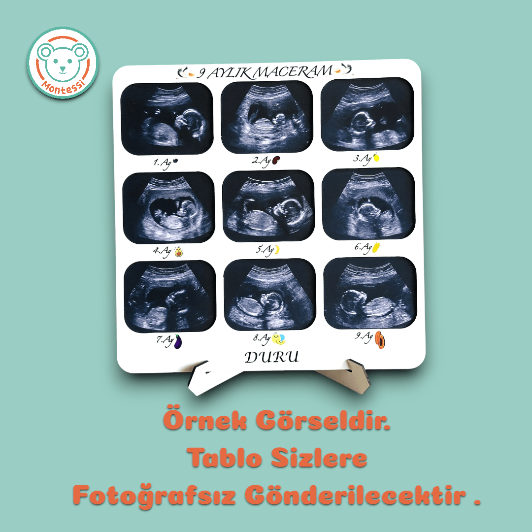Anne Karnı Ultrason Görüntüleri Hatıra Çerçevesi