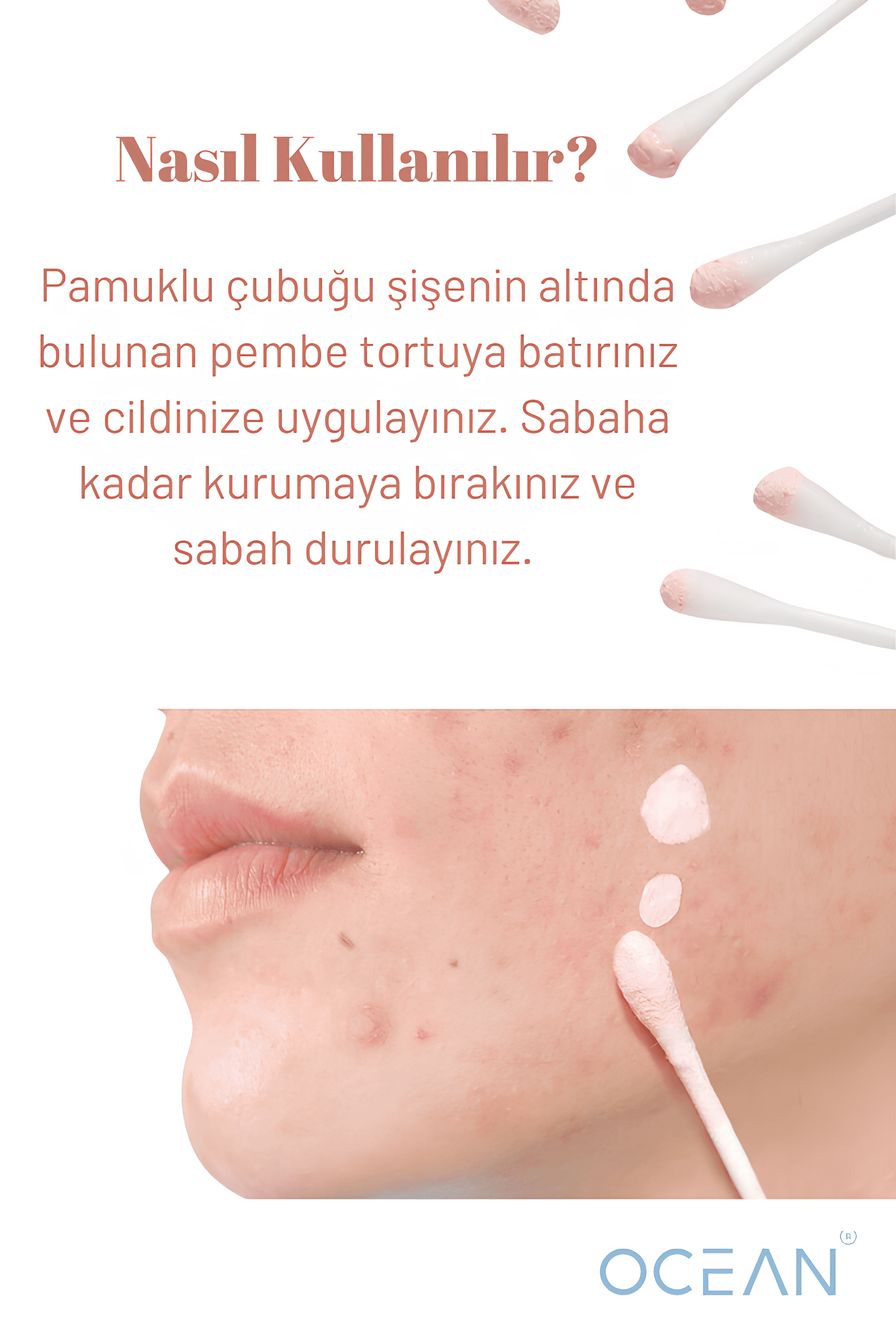 Antı Acne Care Lotion - Akne Kurutucu Losyon