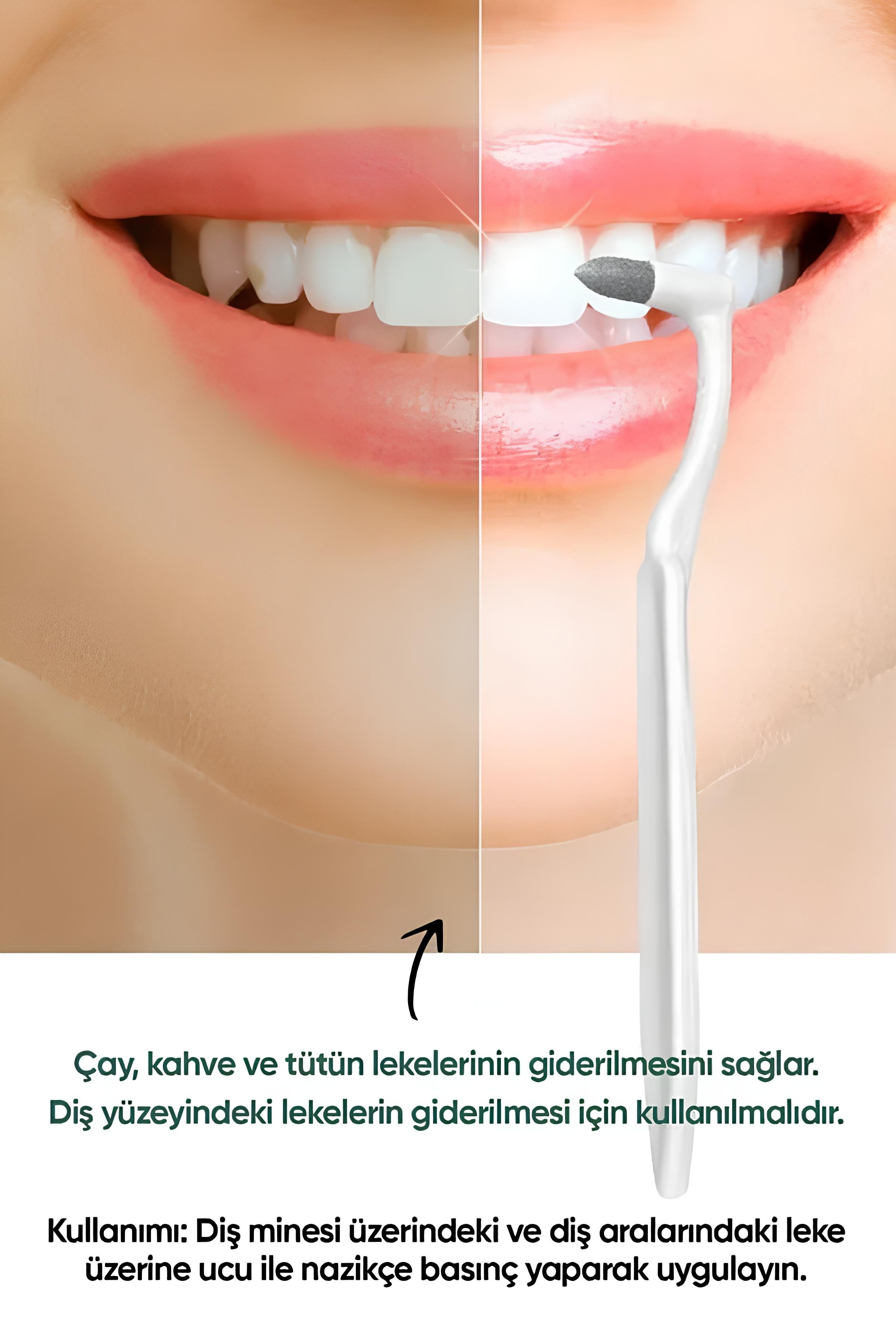 Diş Temizleyici, Diş Lekesi Alıcı ve Parlatıcı Diş Silgisi