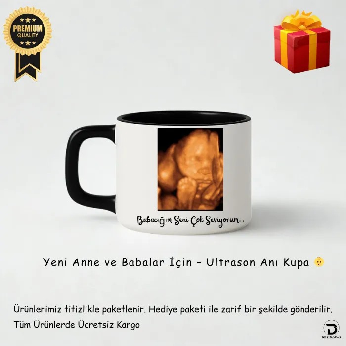 Yeni Anne Babalara Özel Ultrason Görüntülü Siyah İçli & Kulplu Lüks Kupa Fincan – Hediye Paketli