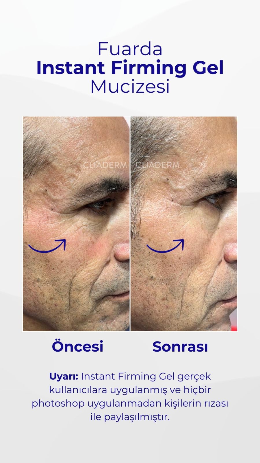 Instant Firming Gel - Anında Sıkılaştırıcı Jel