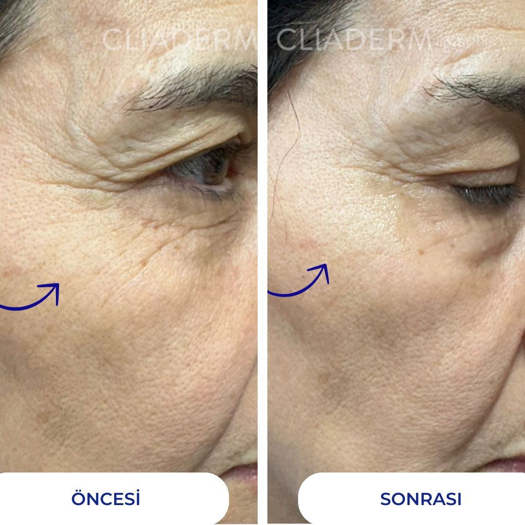 Instant Firming Gel - Anında Sıkılaştırıcı Jel