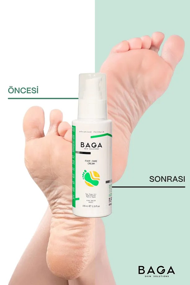 BAGA Yara ve Çatlak Onarıcı Topuk Ayak Bakım Kremi 100 ML