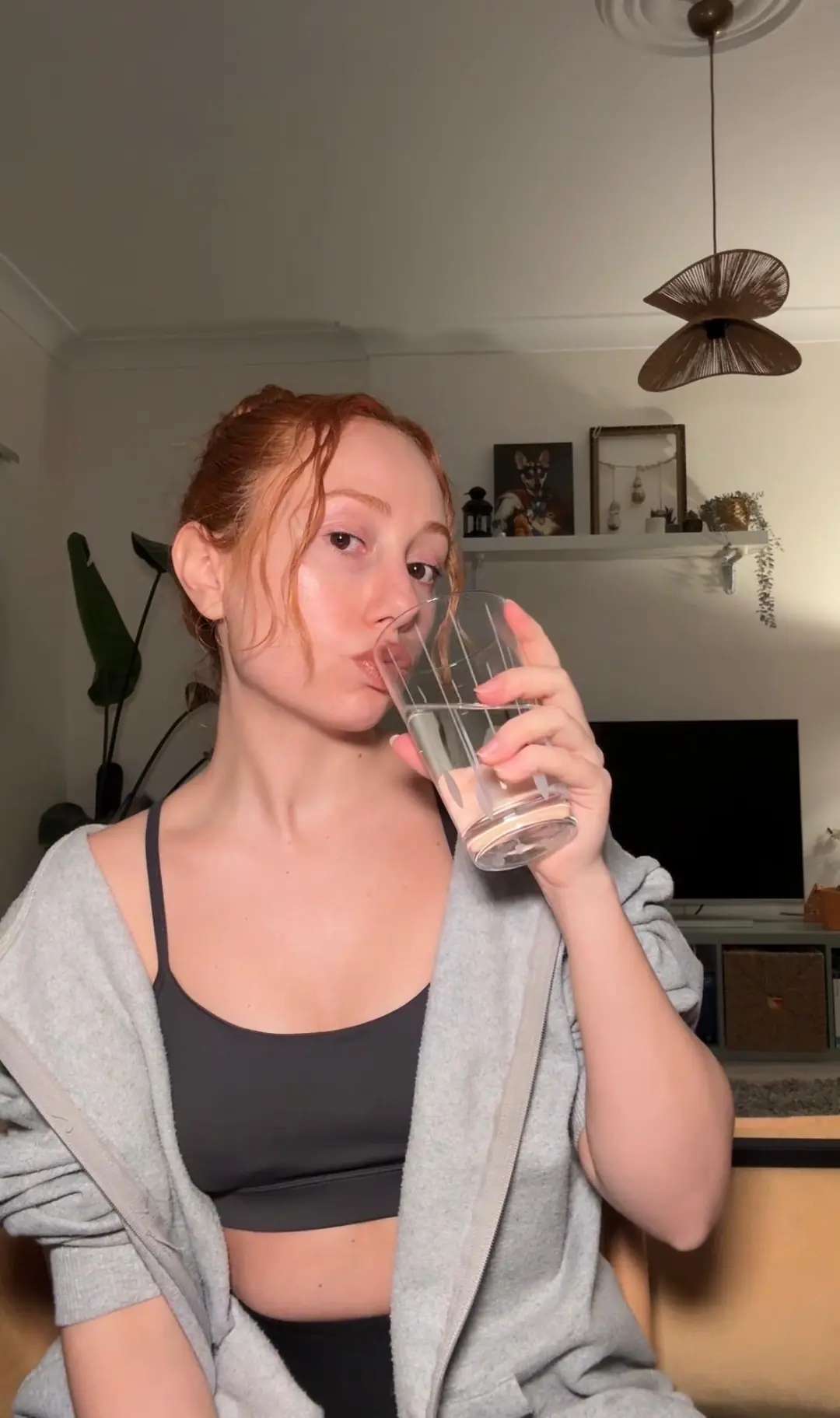 Bu fotoğraf en güncel halime ait. İlk fotoğraflardan yaklaşık 5 yıl sonra ve 6 kilo almış olmama rağmen yüz hatlarım çok daha dengeli ve belirgin görünüyor. Seans öncesinde çekilmiş bir fotoğraf. Burnumdaki ödemin azalması ve yapılan şekillendirme çalışmalarıyla burnum daha ince görünüyor. Çene hattım artık çok daha net ve belirgin. Göz kapağı düşüklüğü olmadığı için yüz ifadem daha dinç ve genç görünüyor. Ayrıca yerleşmiş bir kırışıklık da bulunmuyor.