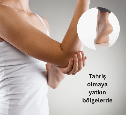 Onarıcı Yoğun Bakım Balmı - Tinker Balm 50 ml
