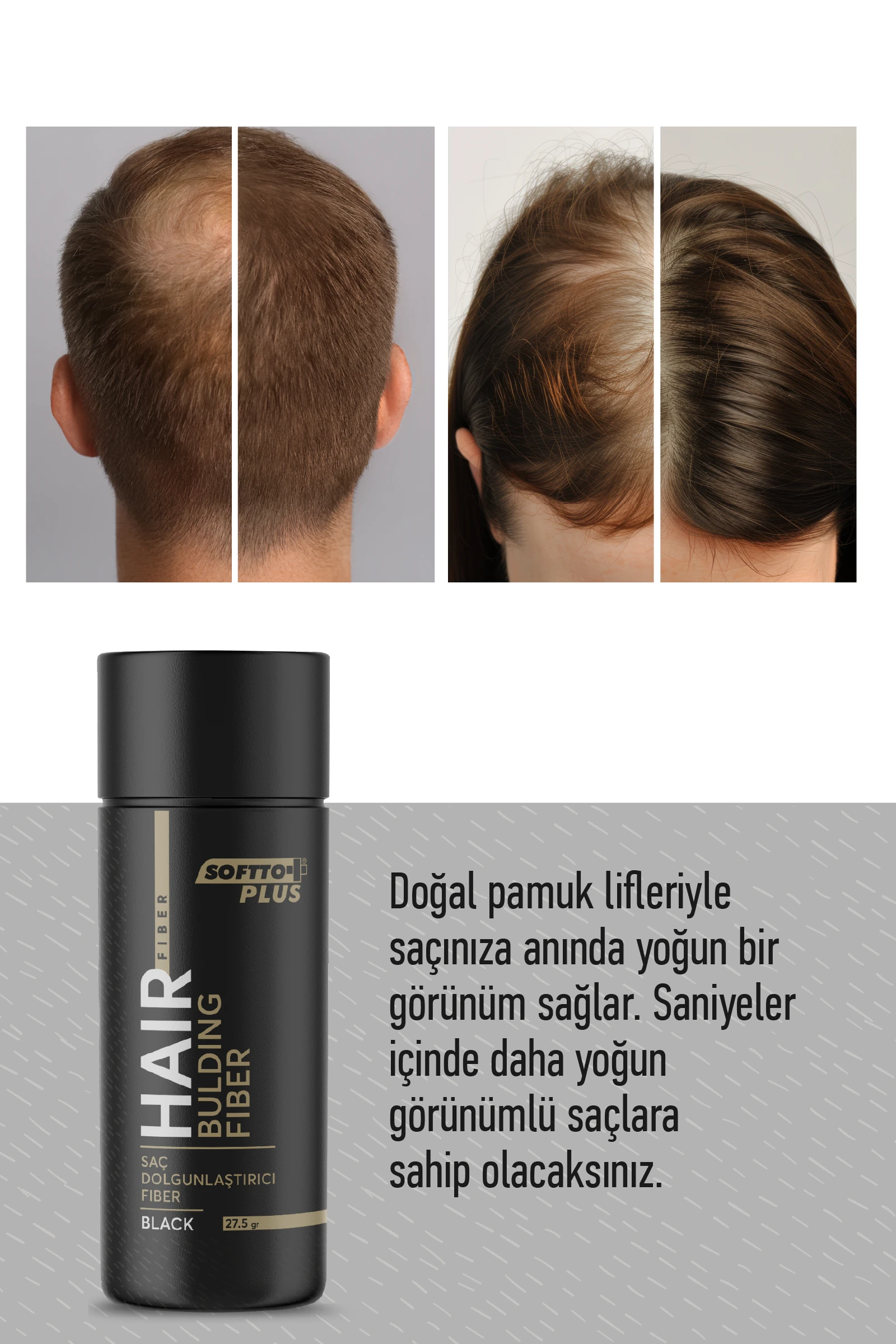 Softto Plus Saç Dolgunlaştırıcı Anında Dolgunluk Sağlayan Siyah Renk Fiber 27.5 gr.