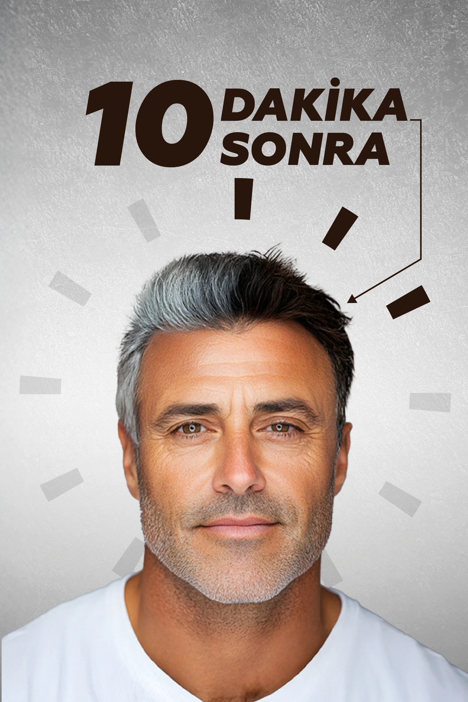 Softto Plus Brown Hair Anında Etkili Beyaz Kapatıcı Koyu Kahverengi Şampuan Boya  25mlx10 adet