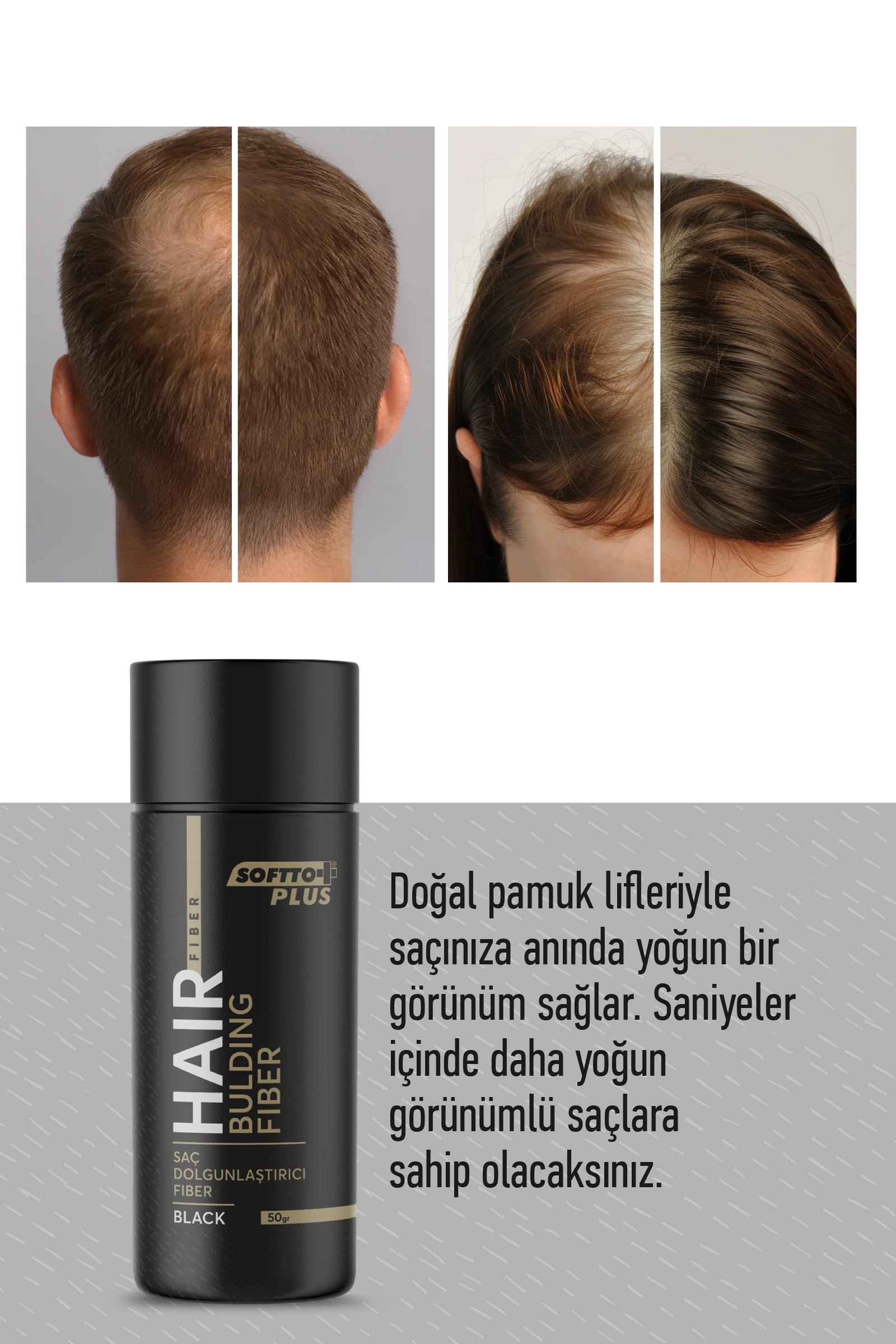 Softto Plus Saç Dolgunlaştırıcı Anında Dolgunluk Sağlayan Siyah Renk Fiber 50 gr.