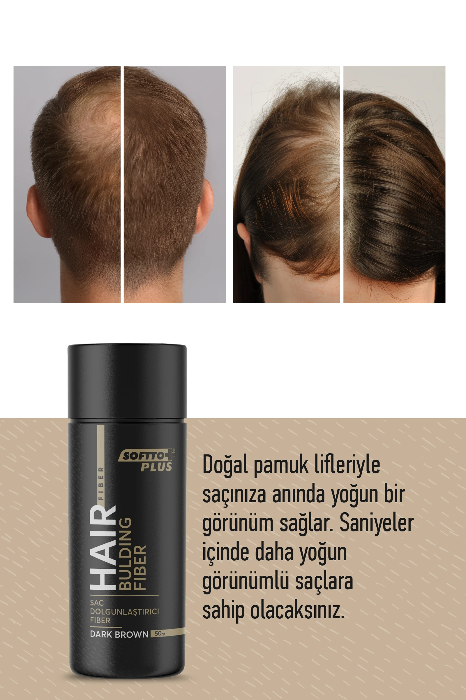 Softto Plus Saç Dolgunlaştırıcı Anında Dolgunluk Sağlayan Koyu Kahverengi Fiber 50 gr.