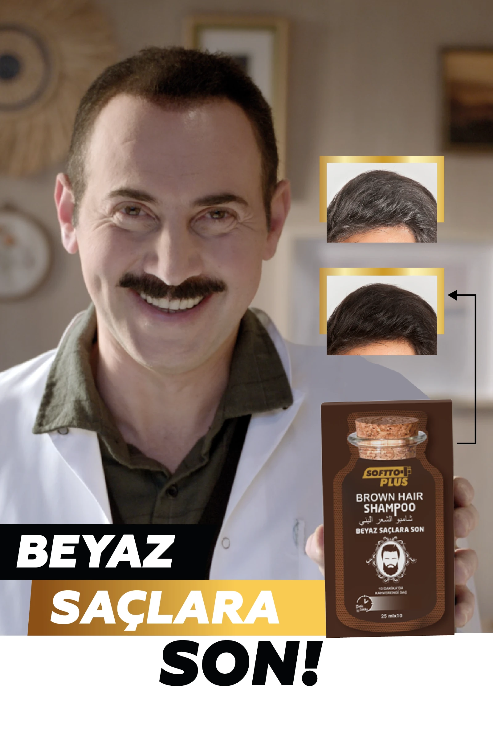 Softto Plus Brown Hair Anında Etkili Beyaz Kapatıcı Koyu Kahverengi Şampuan Boya  25mlx10 adet