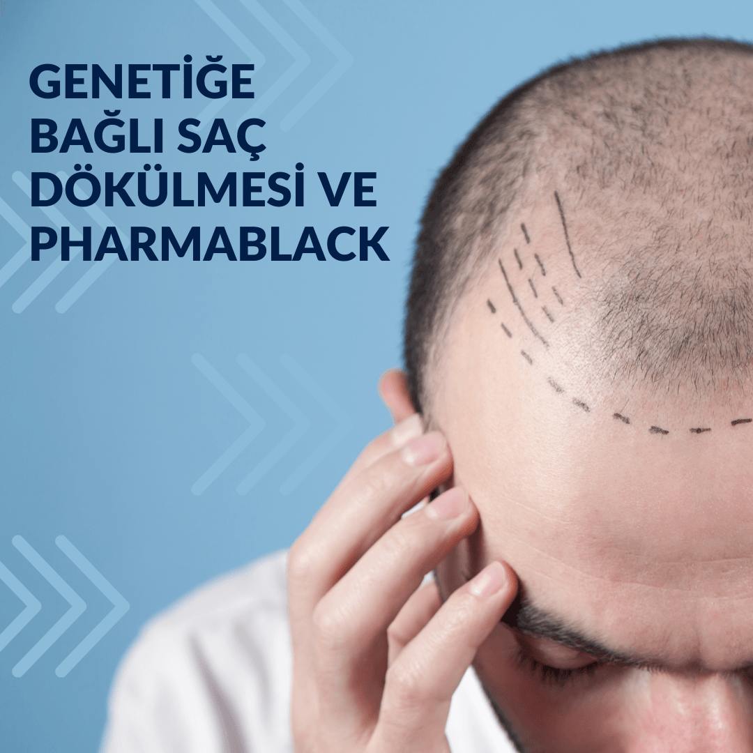 Genetik Saç Dökülmesi: Doğal Çözümlerle Güçlü Saçlar