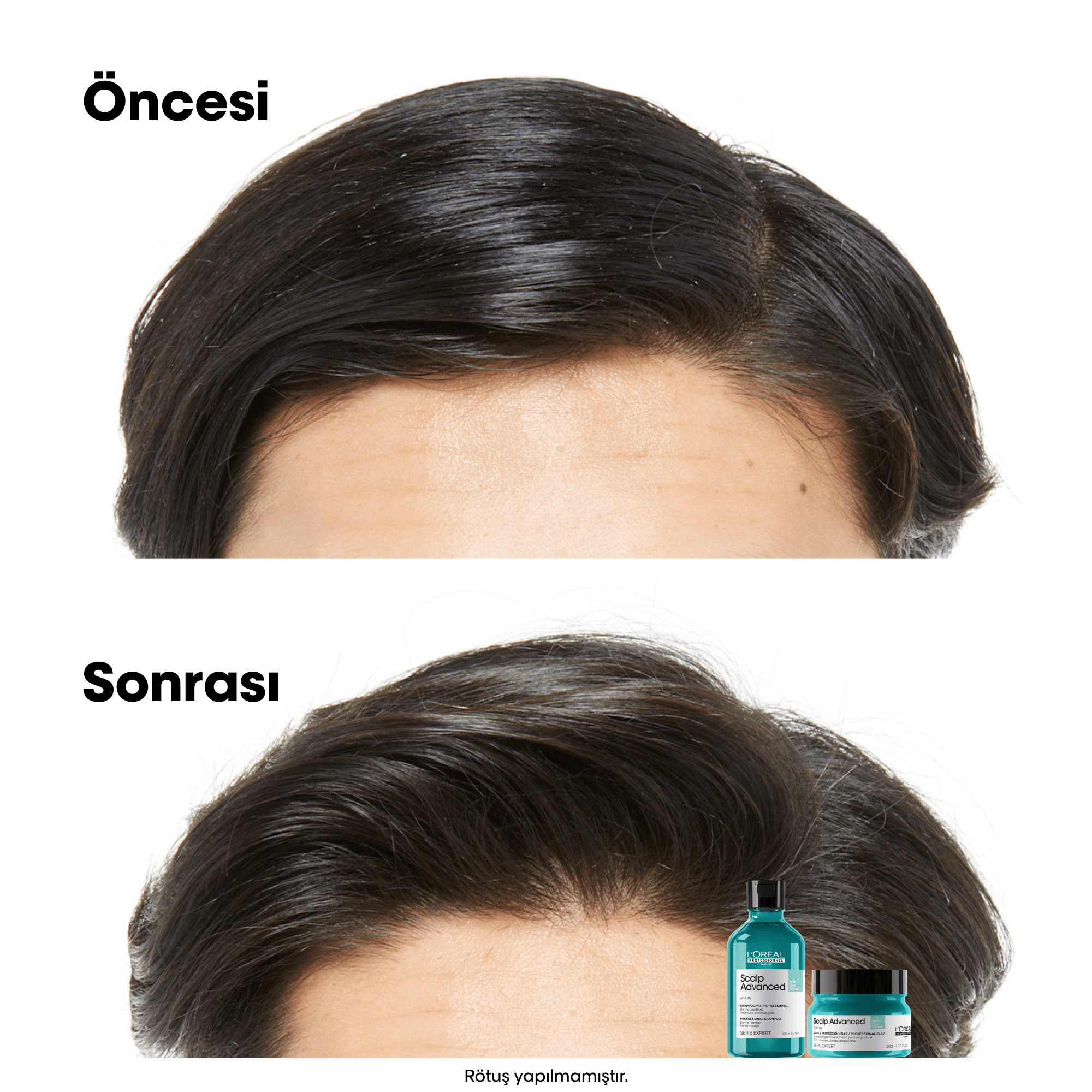 Loreal Professionnel Paris Serie Expert Scalp Advanced Yağlanma Karşıtı Profesyonel Şampuan 500 ml
