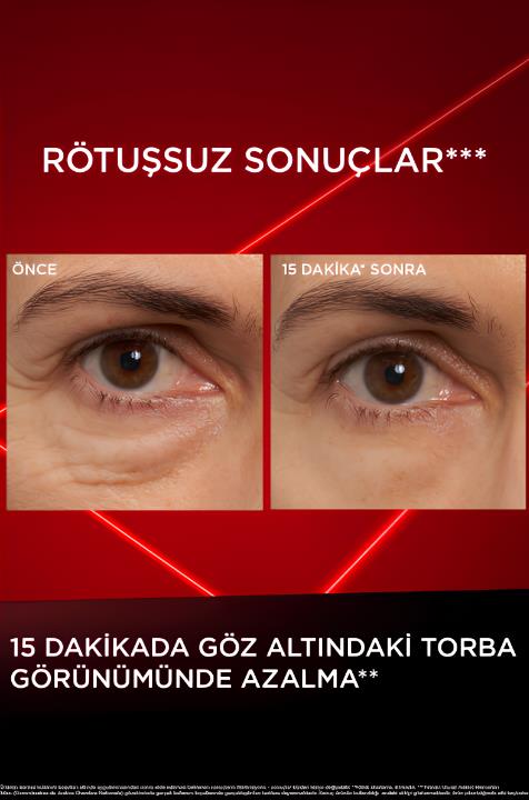 L'Oréal Paris Revitalift Lazer Eyebag Instant Eraser Göz Altı Torba Görünümüne Karşı Etkili Göz Kremi 15ml