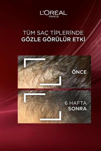 L'Oréal Paris Elseve Komple Direnç Dökülme Karşıtı Bakım Kremi 250ml