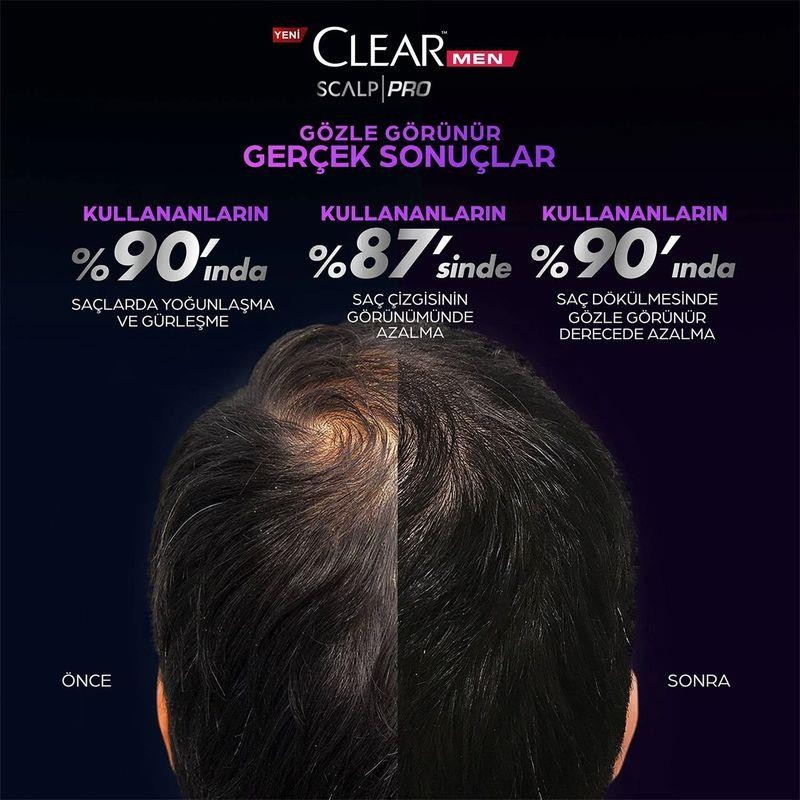 Clear Men Scalp Pro Saç Dökülmesine Karşı Güçlendirici Şampuan 300 ml