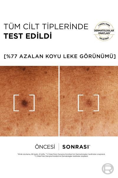 Loreal Paris Bright Reveal Niasinamid Koyu Leke Karşıtı Serum 30 ml