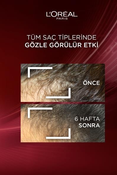 L'Oréal Paris Elseve Komple Direnç Dökülme Karşıtı Şampuan 300 ml