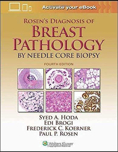Rosen`s Diagnosis of Breast Pathology