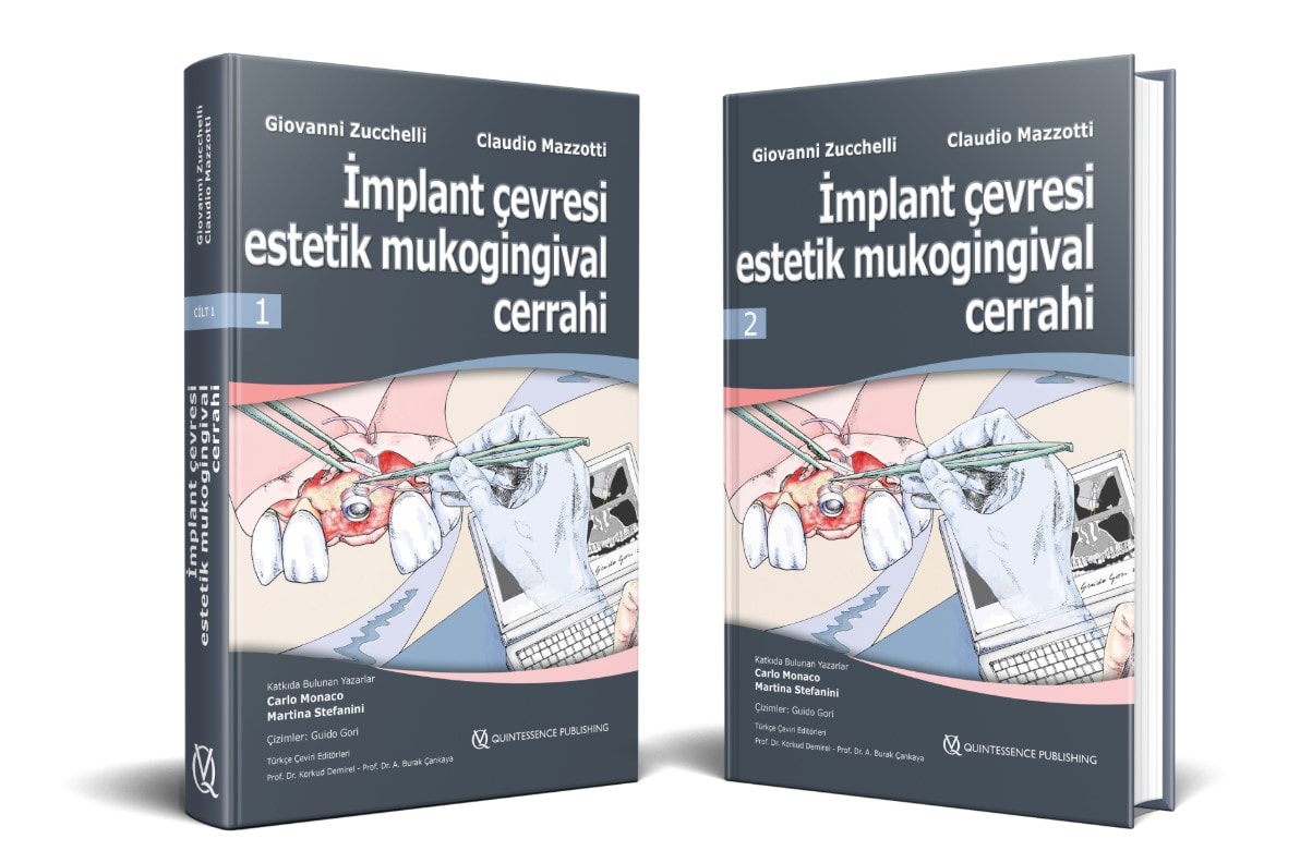 İmplant Çevresi Estetik Mukogingival Cerrahi