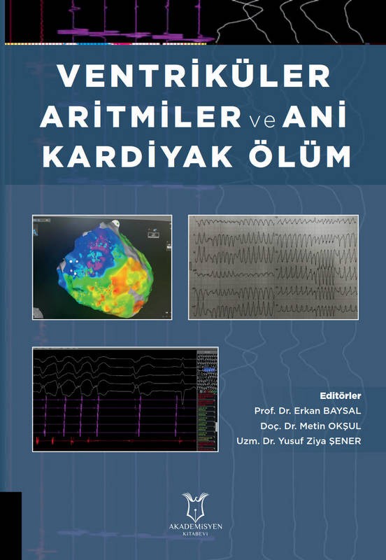 Ventriküler Aritmiler ve Ani Kardiyak Ölüm