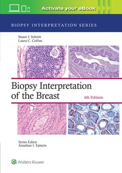 Biopsy Interpretation of the Breast: Print + eBook with Multimedia,4th Edition