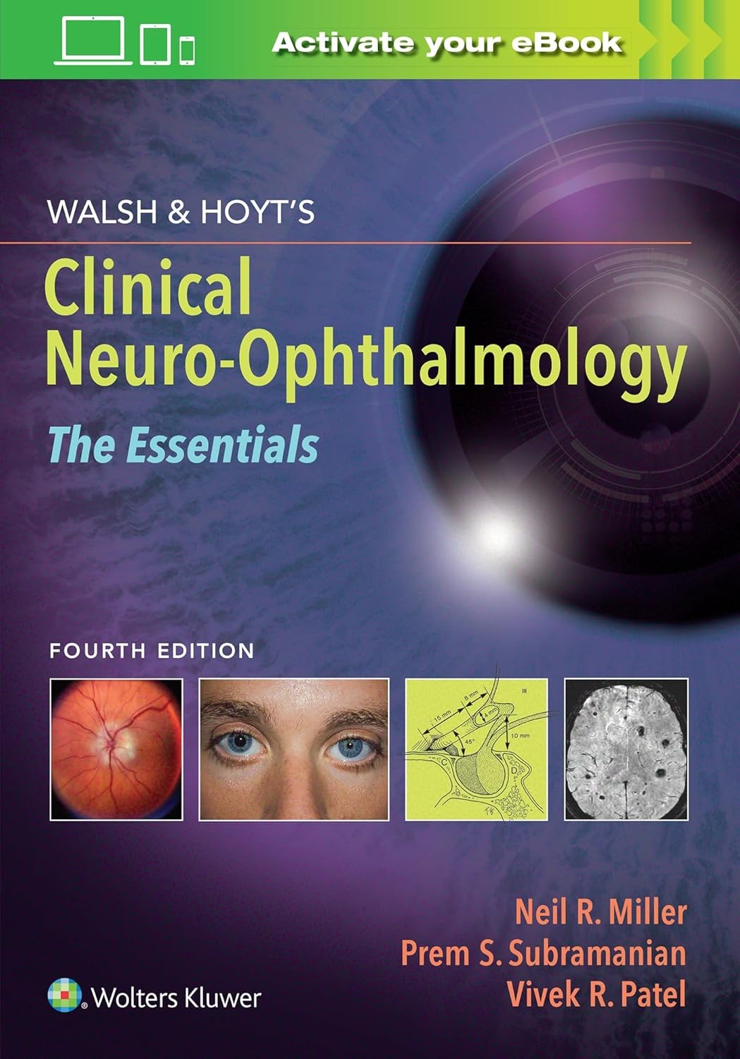 Walsh & Hoyt's Clinical Neuro-Ophthalmology: The Essentials 4th Edition