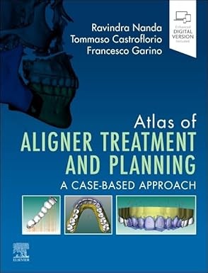 Atlas of Aligner Treatment and Planning: A Case-Based Approach