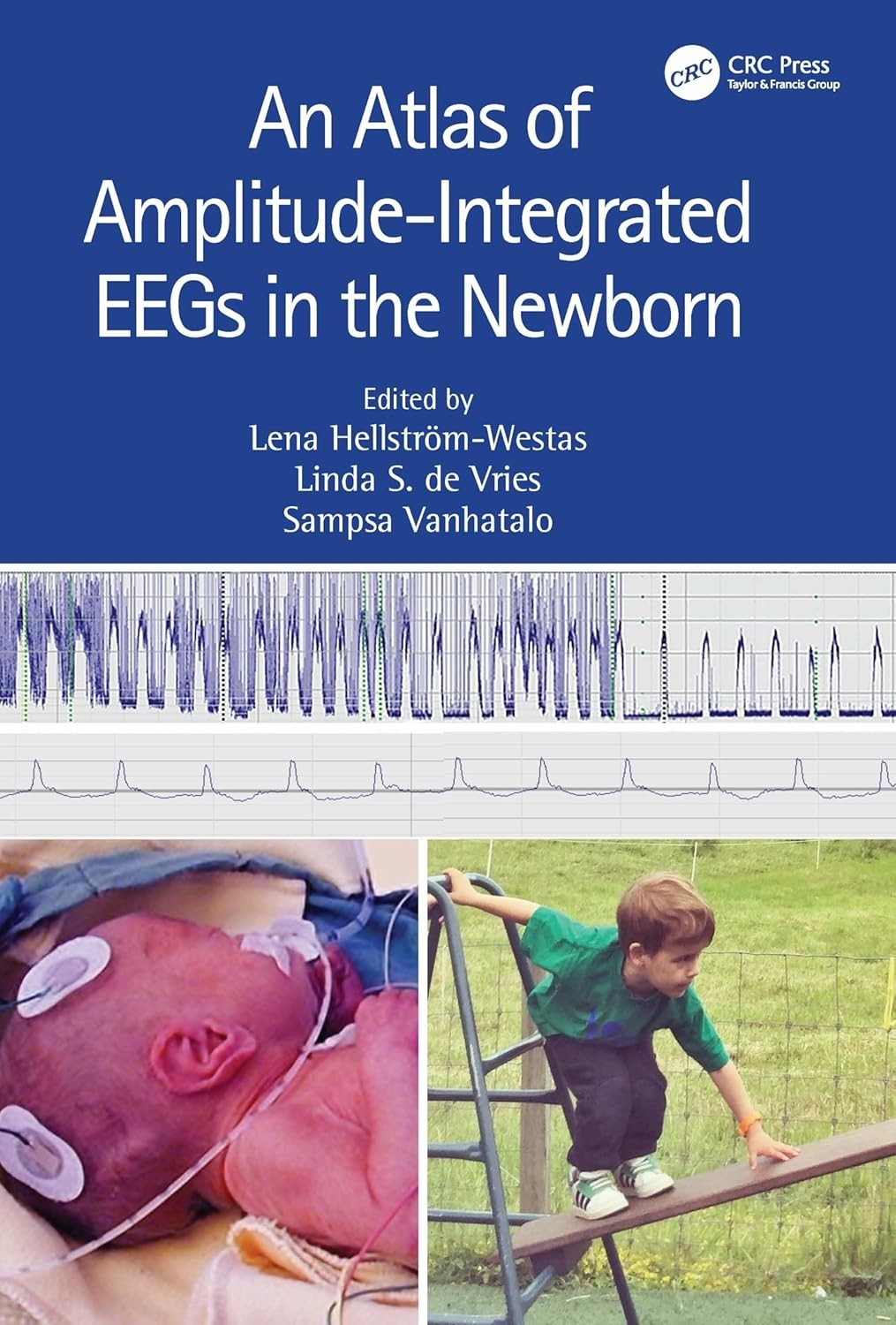 An Atlas of Amplitude-Integrated EEGs in the Newborn,3rd Edition