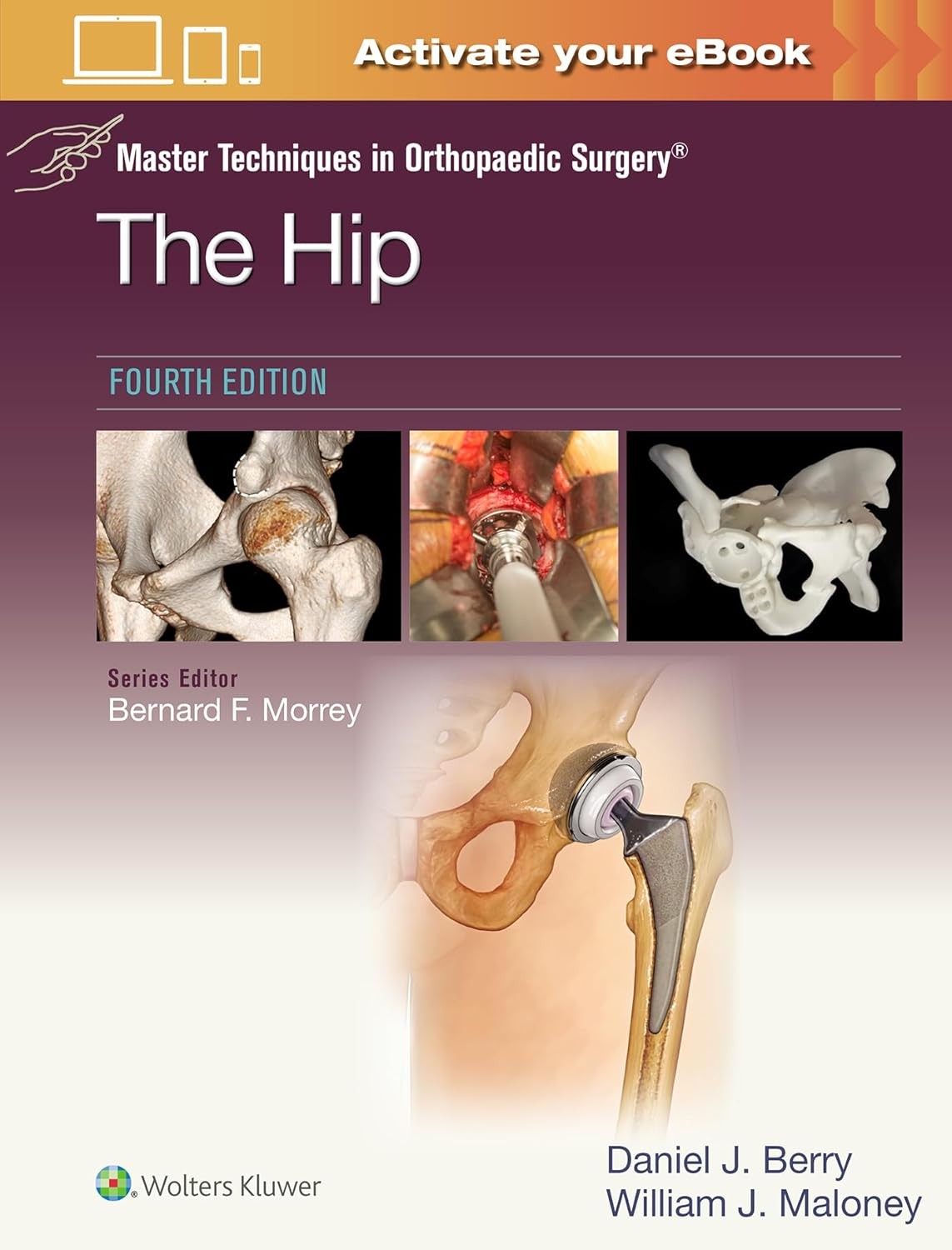 Master Techniques in Orthopaedic Surgery The Hip Print + eBook with Multimedia