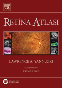 Yannuzzi Retina Atlası